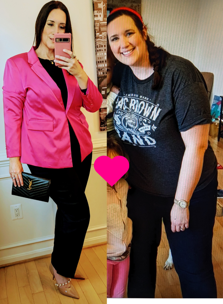 Loose Skin After Weight Loss Countess of Shopping